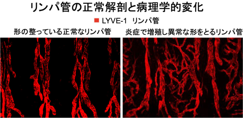 リンパ浮腫に関する基礎研究