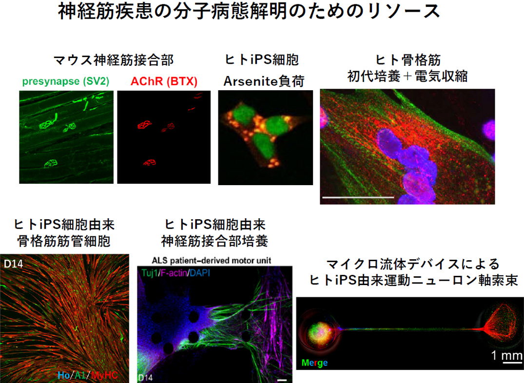 神経筋疾患に関する病態・治療研究
