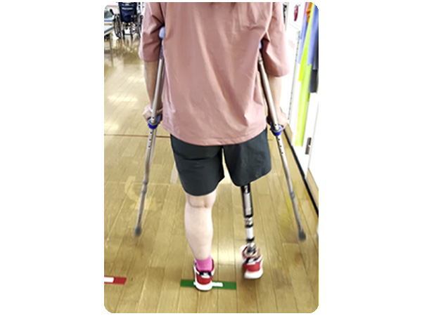 切断・脊髄損傷のリハビリテーション